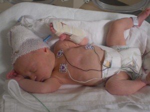 In NICU